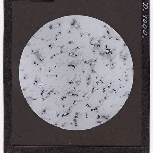 Typhus bacillus enlarged under a microscope