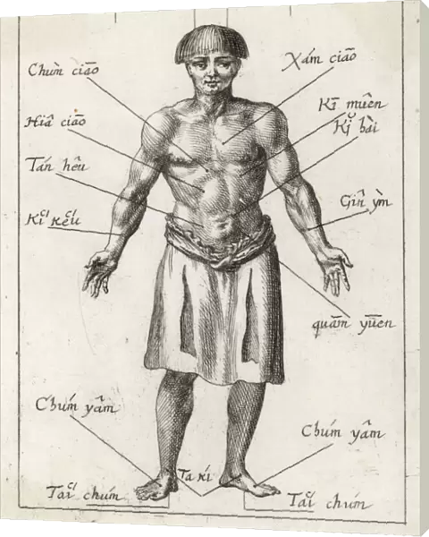 Acupuncture in 17th Cent