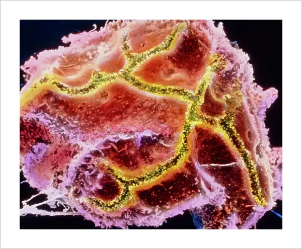Coloured SEM of a liver cell known as hepatocyte
