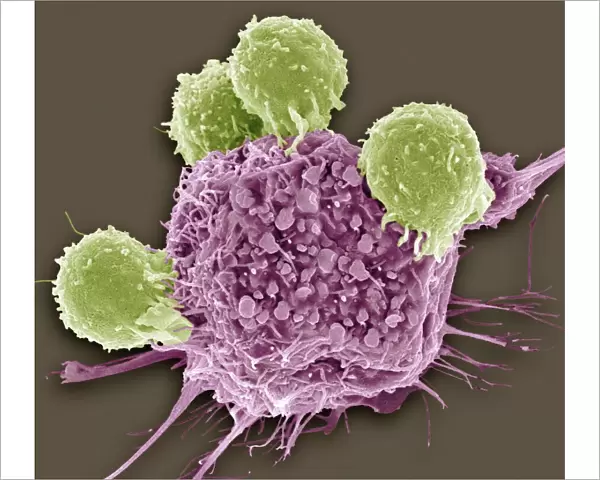 T lymphocytes and cancer cell, SEM C001  /  1679