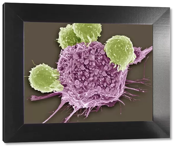 T lymphocytes and cancer cell, SEM C001  /  1679