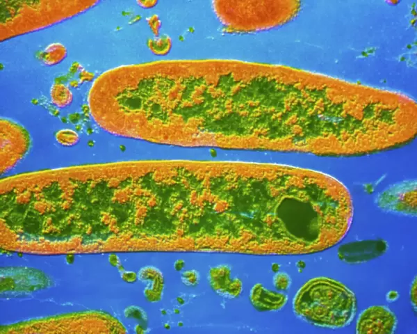 Coloured TEM of Yersinia pestis bacteria