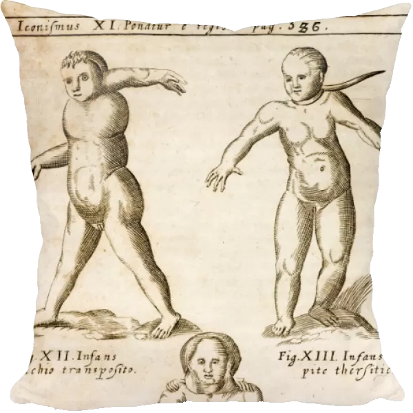 1662 Schott birth defects, teratology