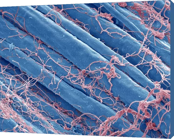 Optic nerve fibres, SEM