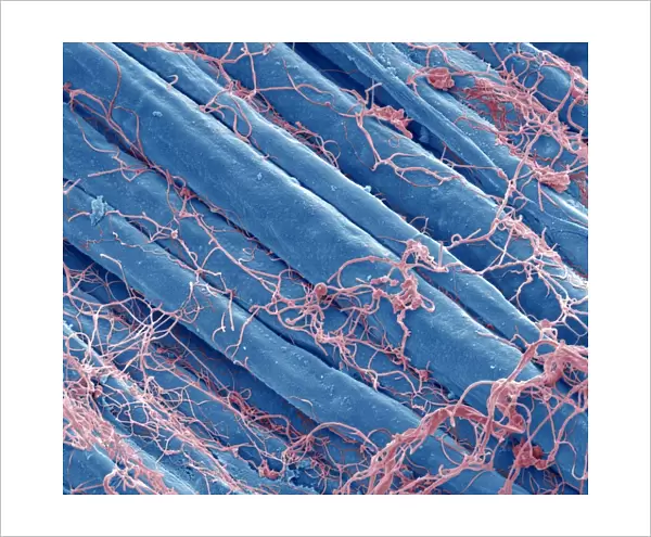 Optic nerve fibres, SEM