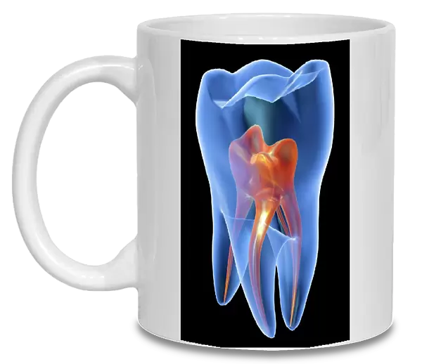Molar tooth