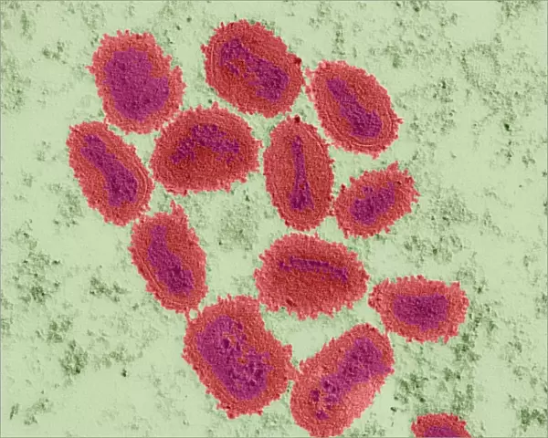 Vaccinia virus particles, TEM