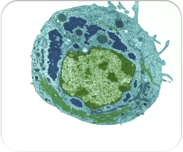 Reovirus particles in a cell, TEM