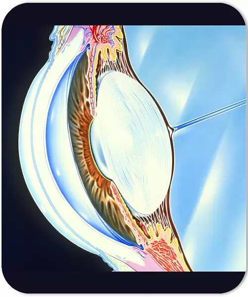 Artwork of the structure of the front of an eye