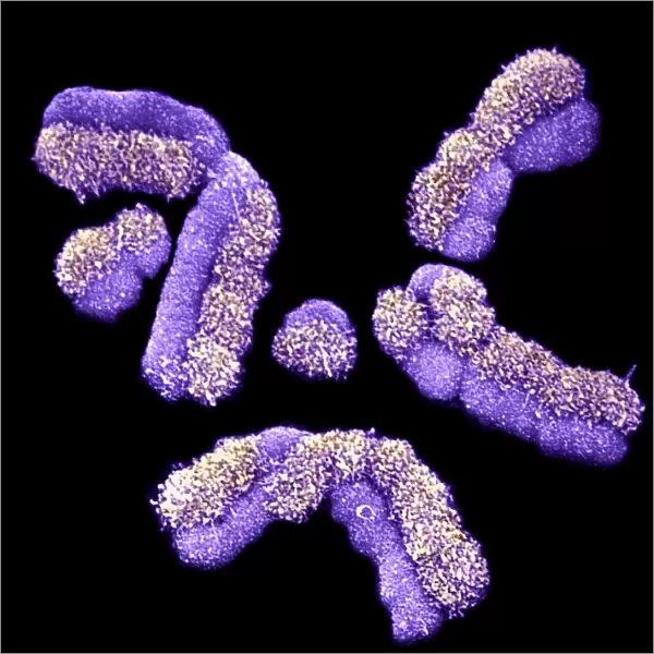 Human chromosomes, SEM C013  /  5002