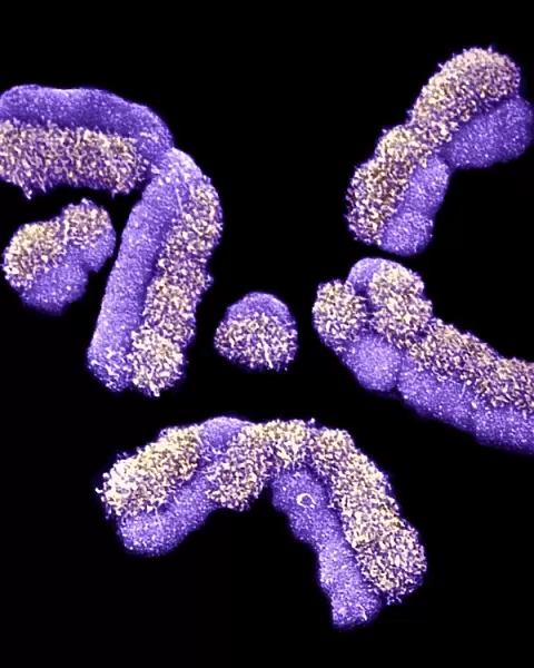 Human chromosomes, SEM C013  /  5002