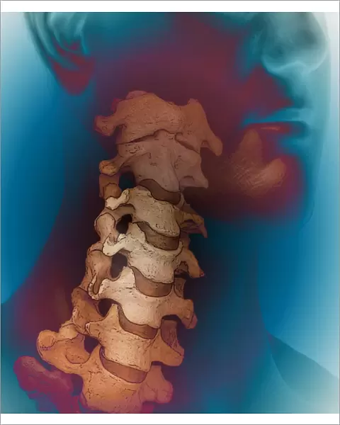 Healthy spine, CT scan C018  /  0444