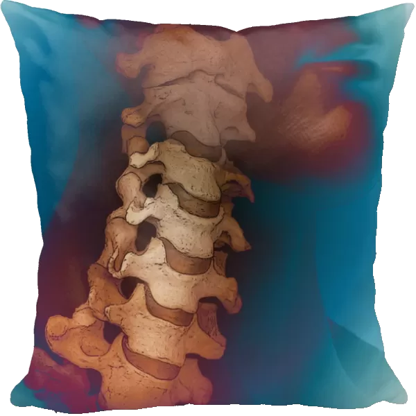 Healthy spine, CT scan C018  /  0444