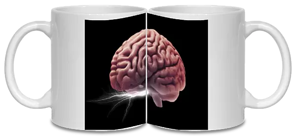 Brain activity, composite image C018  /  0652
