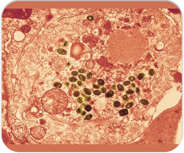 Smallpox virus particles, TEM C016  /  9447