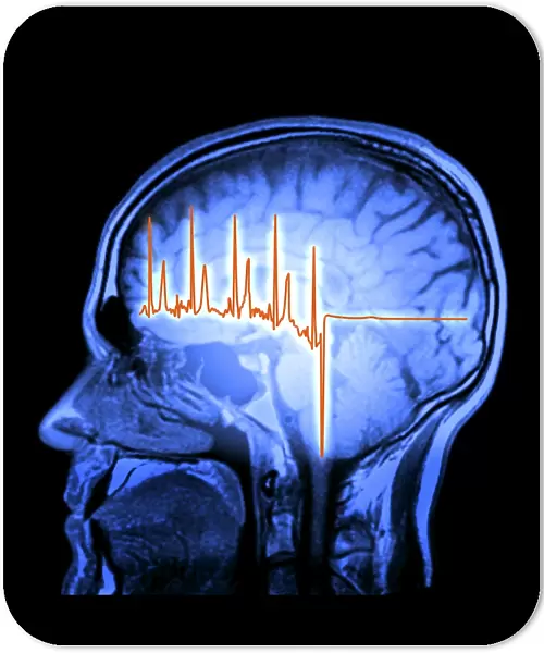 ECG trace and mri brain scan, artwork