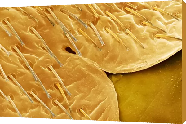 Female bedbugs abdomen, SEM