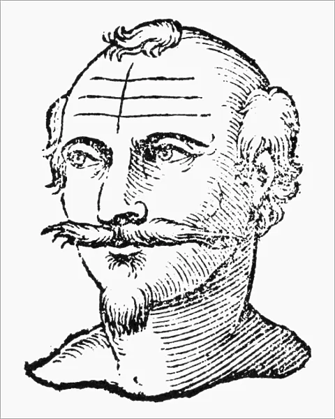PHYSIOGNOMY, 1637. Forehead of an imbecile and long-lived man
