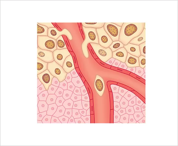 Digital illustration of blood vessel wall rupturing, primary tumour expanding, cells rupturing walls of blood vessels, enabling cancerous cells to detach and spread via blood flow