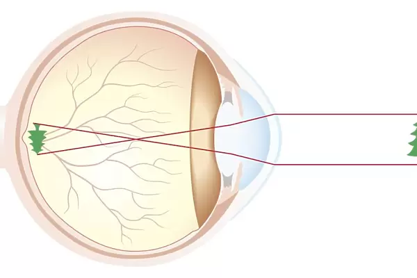 Cross section of human eye