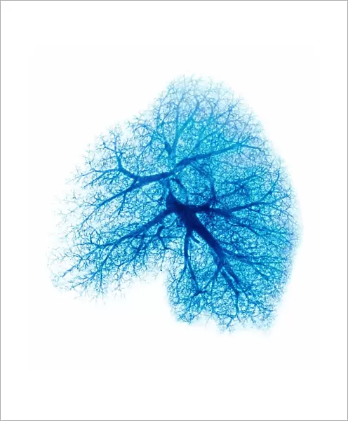 Lung, X-ray