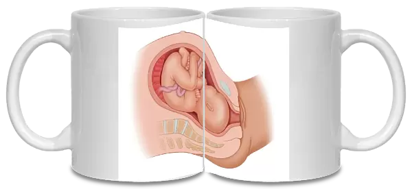 Cross section of the mothers anatomy showing the baby in uteruo ROP