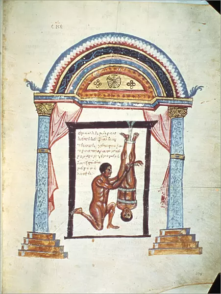 Treatment of a dislocation, from a commentary of Apollonius of Citium (1st century BC