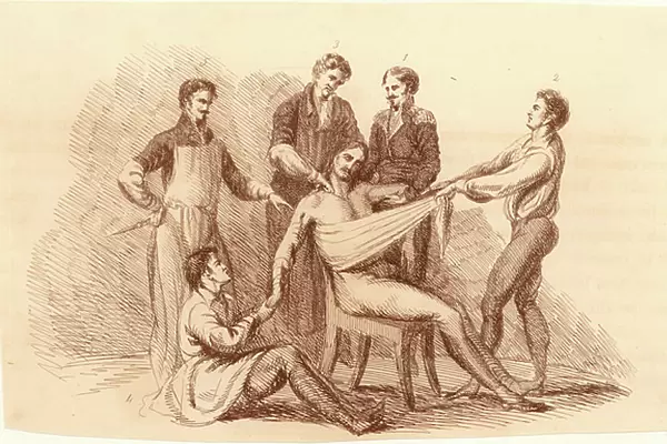 Surgeon and his assistants, before the introduction of anaesthetics, prepared to perform an amputation at the shoulder. Surgeon stands, left, next the assistant surgeon (behind patient)