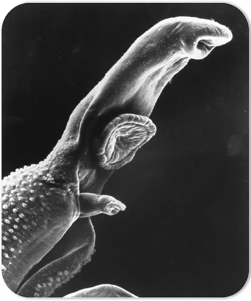 Scanning electron micrograph of a schistosome parasite