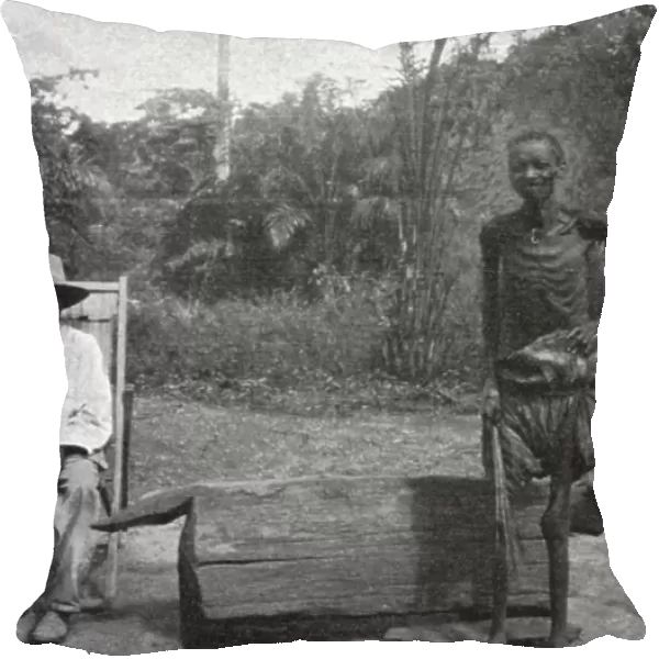 Indigene du Congo atteint de la maladie du sommeil; L'Ouest Africain, 1914. Creator: Unknown