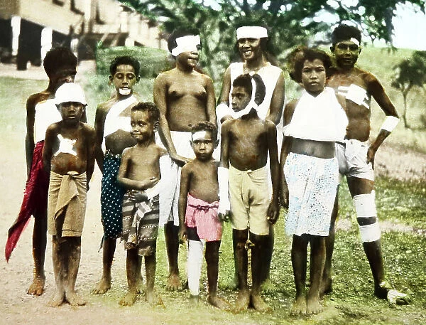 Patients at a Mission Hospital, Port Moresby, PNG