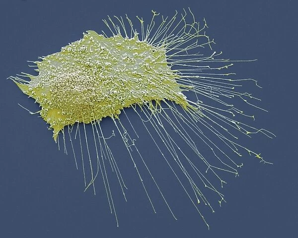 Bone cancer cell, SEM F006  /  8638