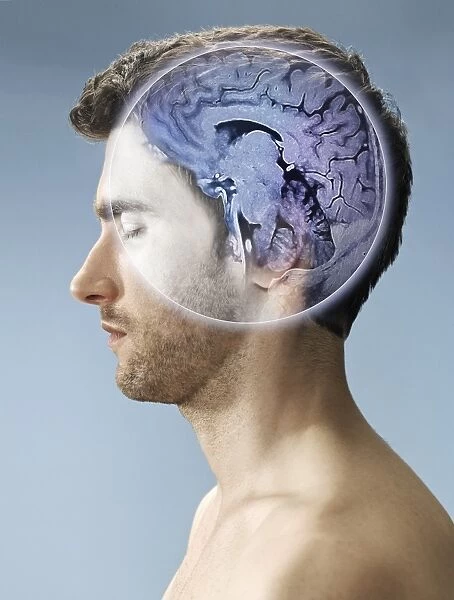 Brain scan, conceptual image C017  /  7394