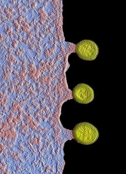 Cell infected with HIV, SEM C017  /  8337