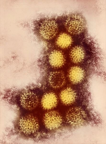 Changuinola virus, TEM