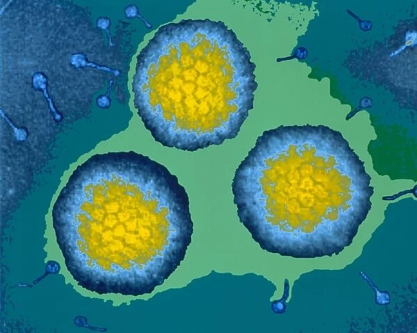 Coloured TEM of three adenoviruses
