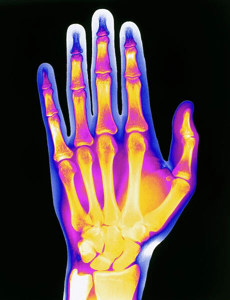 Coloured X-ray of the healthy hand of a man