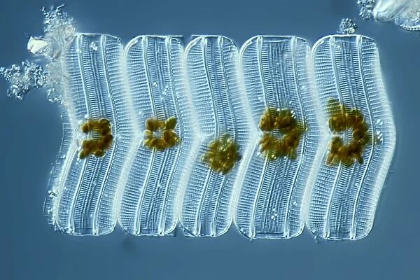 Diatoms, light micrograph C014  /  4671