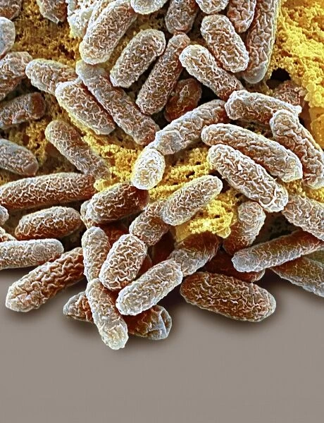 E coli bacteria, SEM F006  /  9921
