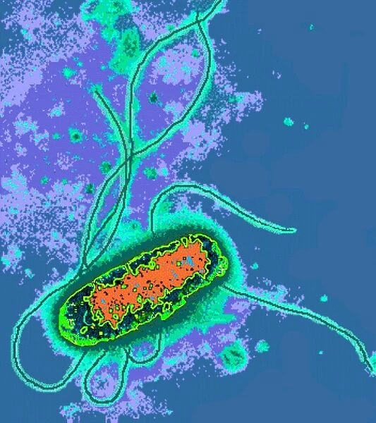 Escherichia coli bacterium