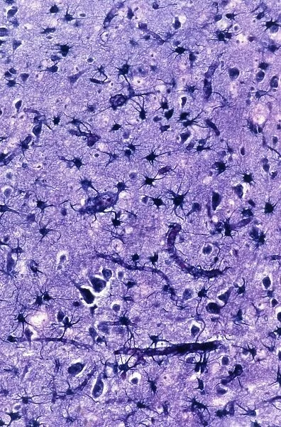 Glial cells, light micrograph