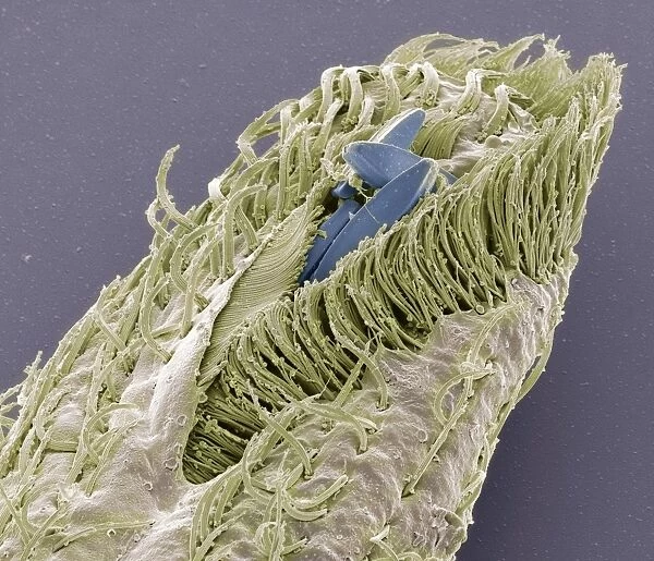 Holosticha ciliate protozoan, SEM