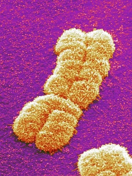 Human chromosome pair, SEM