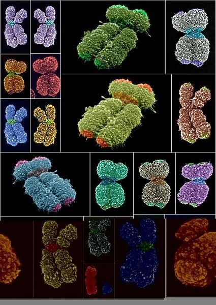 Human chromosomes, SEMs C013  /  4989