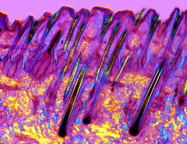 Human skin, polarised light micrograph