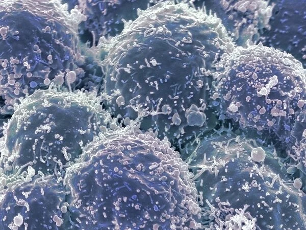 Lung cancer cells, SEM F006  /  8641
