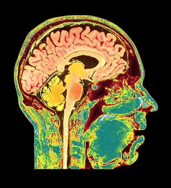 Normal human brain, MRI scan C016  /  8850