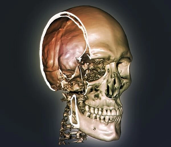 Normal skull, 3D CT scan C016  /  6330