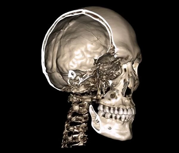 Normal skull, 3D CT scan C016  /  6331