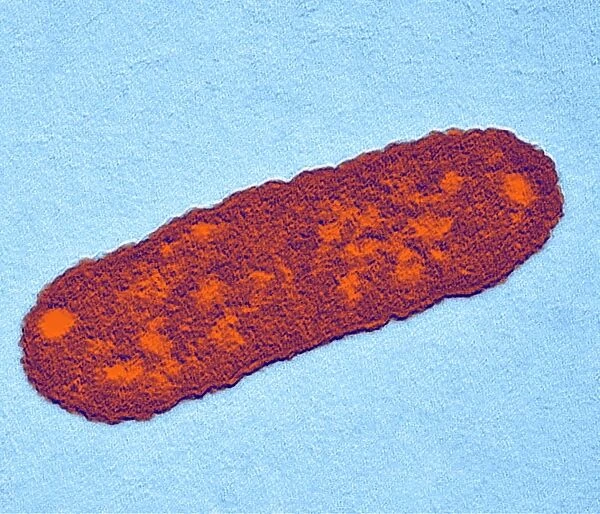 Salmonella bacterium, TEM